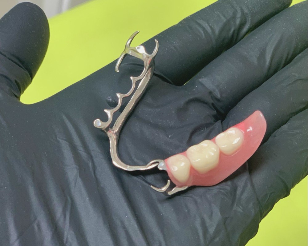 протезування зубів стоматологія Crystal Dent